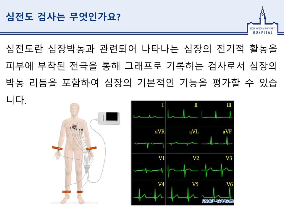 심전도 검사는 무엇인가요심전도란 심장박동과 관련되어 나타나는 심장의 전기적 활동을 피부에 부착된 전극을 통해 그래프로 기록하는 검사로서 심장의 박동 리듬을 포함하여 심장의 기본적인 기능을 평가할 수 있습니다. 그림-심전도하는 모습 그리고 정상 심전도파형