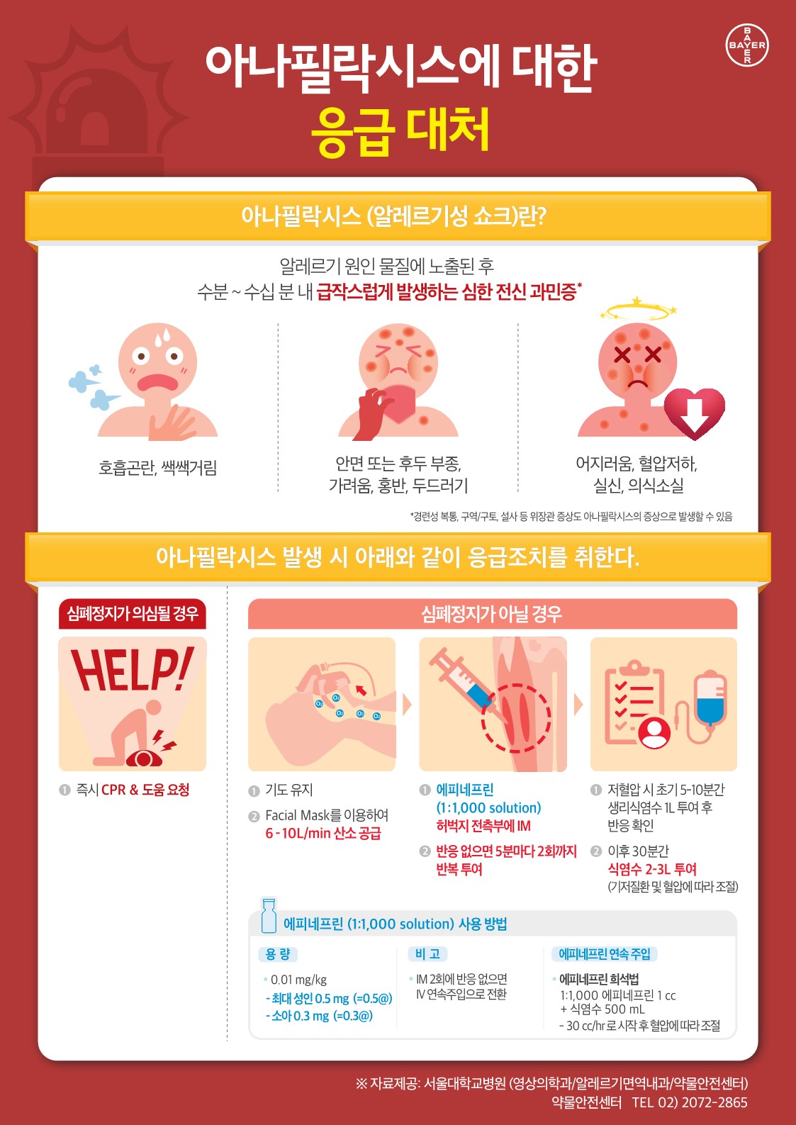 아나필락시스대처