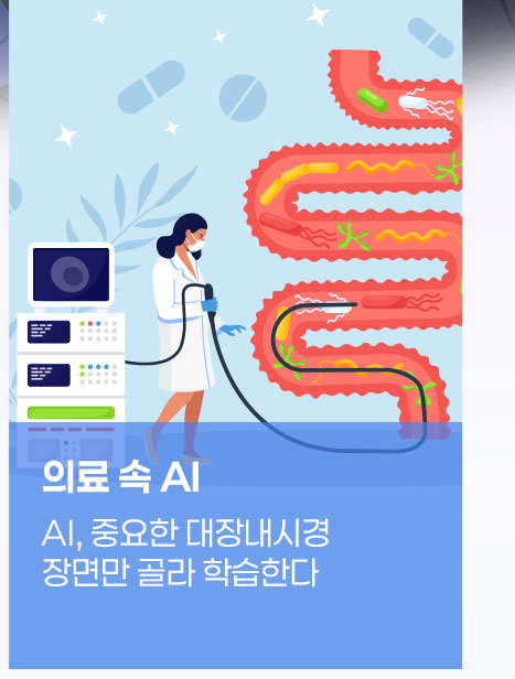 AI, 중요한 대장내시경 장면만 골라 학습한다