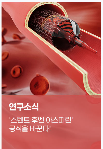 '스텐트 후엔 아스피린' 공식을 바꾼다!